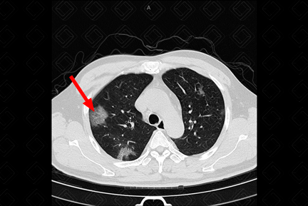 Texto alternativo para a imagem