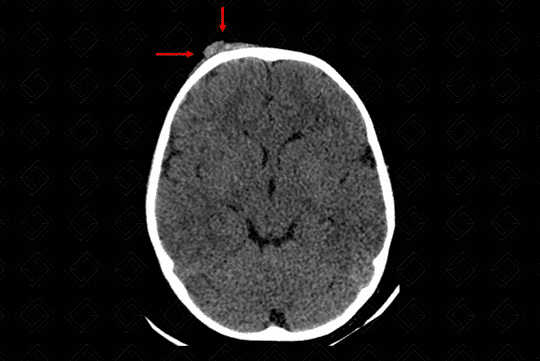 Texto alternativo para a imagem
