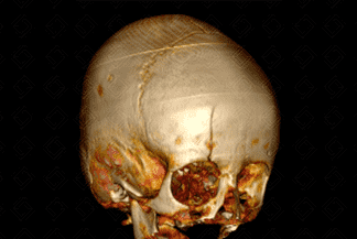 Texto alternativo para a imagem