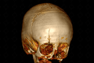 Texto alternativo para a imagem