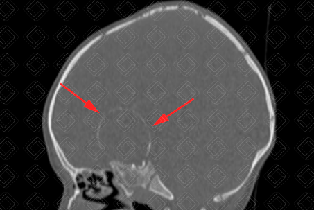 Texto alternativo para a imagem