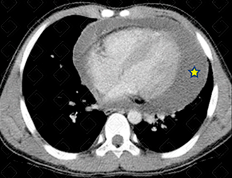 Texto alternativo para a imagem