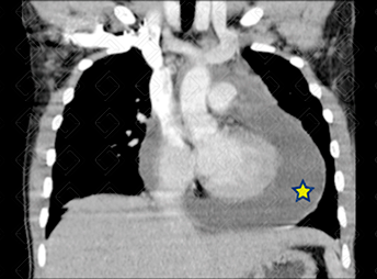 Texto alternativo para a imagem