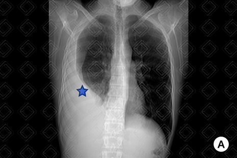 Texto alternativo para a imagem