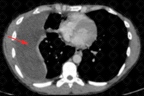 Texto alternativo para a imagem