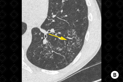 Texto alternativo para a imagem