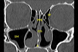 Texto alternativo para a imagem