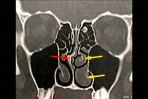 Texto alternativo para a imagem