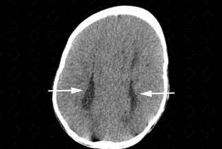 Texto alternativo para a imagem