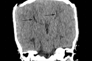 Texto alternativo para a imagem