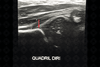 Texto alternativo para a imagem