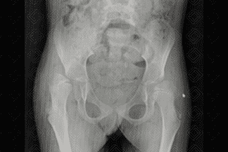 Texto alternativo para a imagem