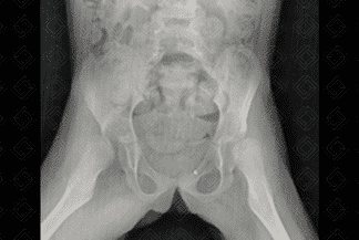 Texto alternativo para a imagem