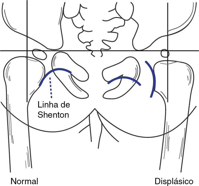 Texto alternativo para a imagem