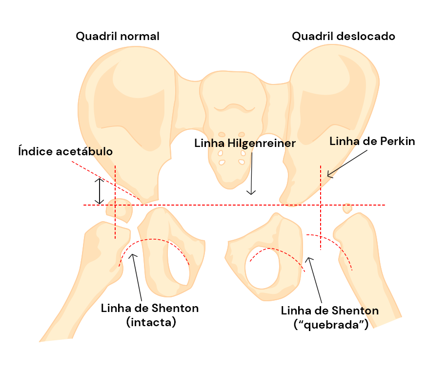 Texto alternativo para a imagem