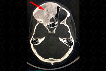 Texto alternativo para a imagem