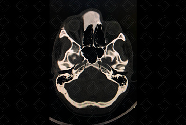 Texto alternativo para a imagem