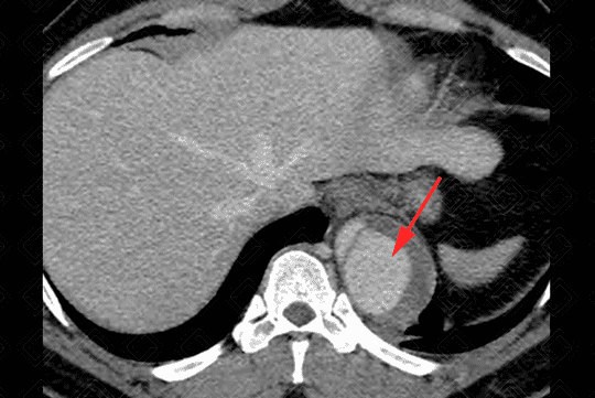 Texto alternativo para a imagem