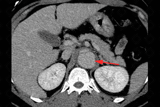 Texto alternativo para a imagem