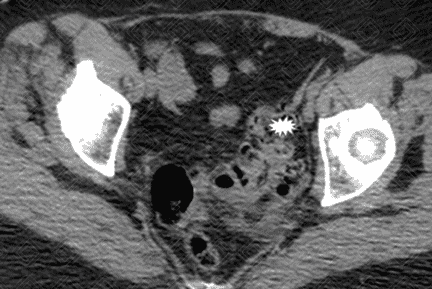 Texto alternativo para a imagem