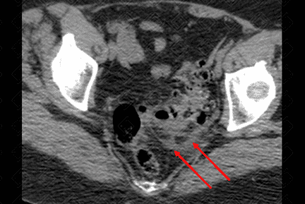 Texto alternativo para a imagem