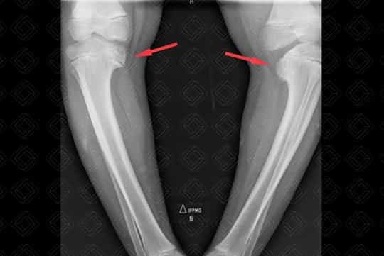 Texto alternativo para a imagem