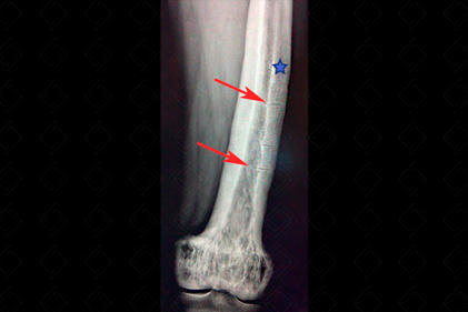 Texto alternativo para a imagem