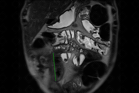 Texto alternativo para a imagem