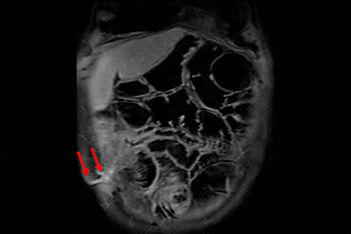 Texto alternativo para a imagem