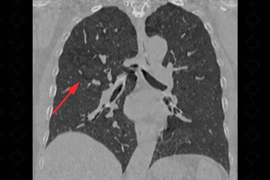 Texto alternativo para a imagem