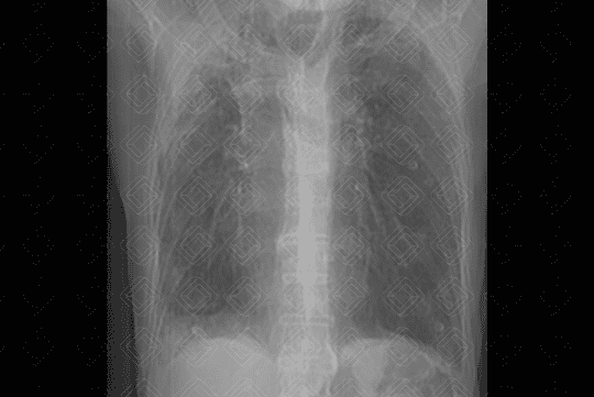 Texto alternativo para a imagem