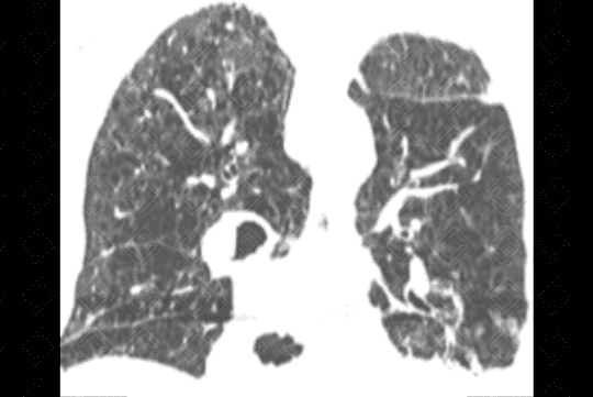 Texto alternativo para a imagem