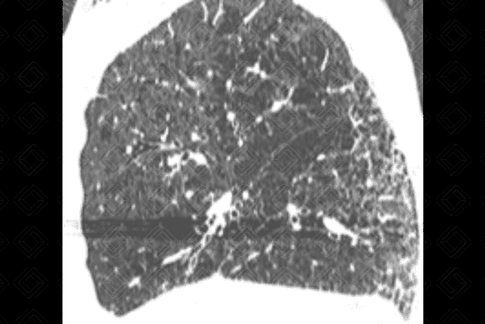 Texto alternativo para a imagem