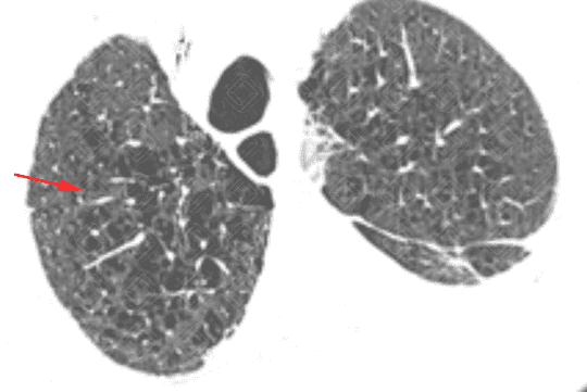 Texto alternativo para a imagem