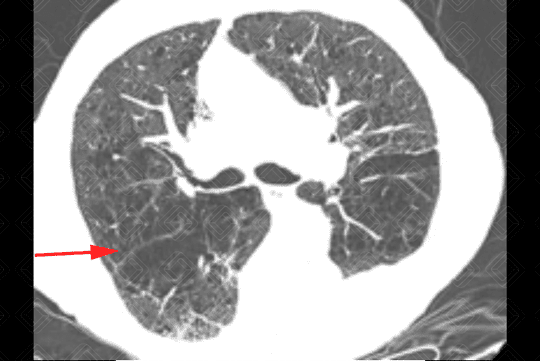 Texto alternativo para a imagem