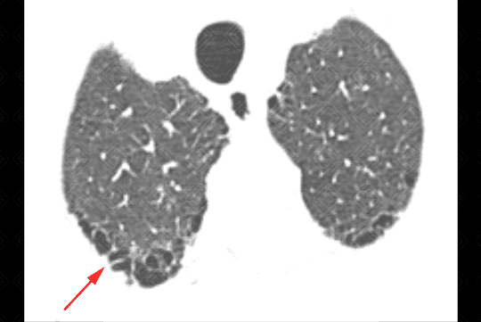 Texto alternativo para a imagem