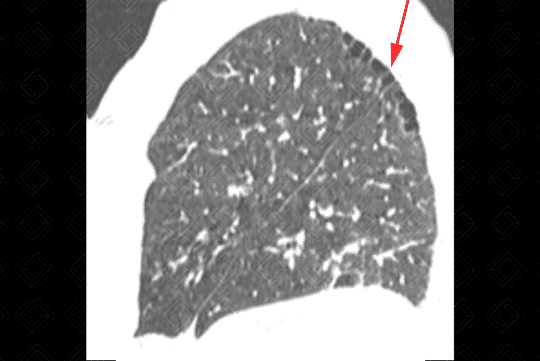 Texto alternativo para a imagem