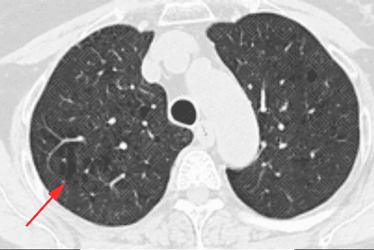 Texto alternativo para a imagem