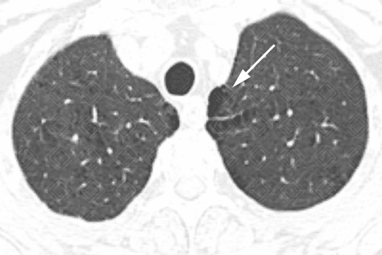 Texto alternativo para a imagem