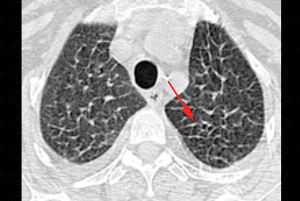 Texto alternativo para a imagem