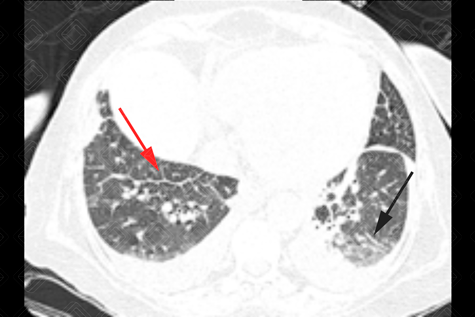 Texto alternativo para a imagem