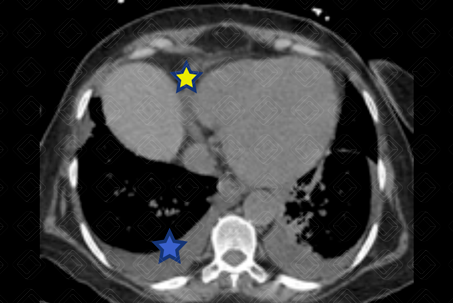 Texto alternativo para a imagem