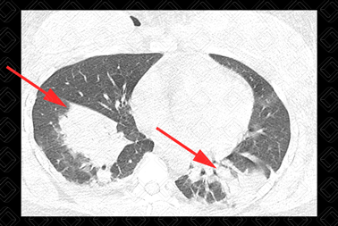Texto alternativo para a imagem