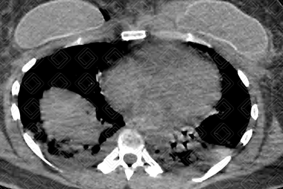 Texto alternativo para a imagem