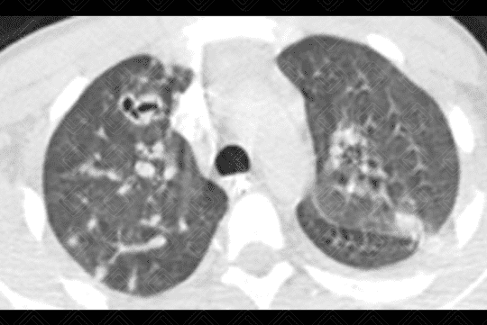 Texto alternativo para a imagem