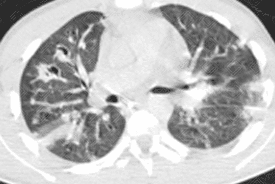 Texto alternativo para a imagem