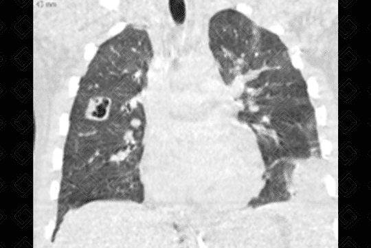 Texto alternativo para a imagem