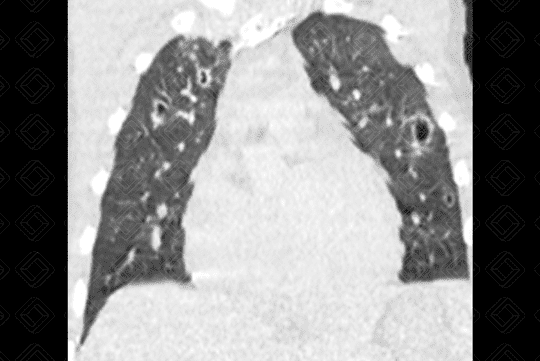 Texto alternativo para a imagem