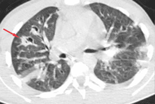 Texto alternativo para a imagem