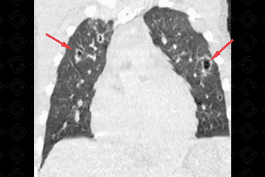 Texto alternativo para a imagem